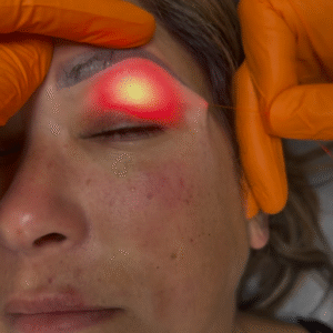 Why Miami Clinics Are Switching to the Endo One Diode Laser