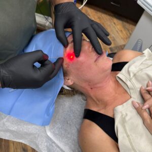 How the Endo One Diode Laser is Changing Skin Care for Miami’s Busy Professionals